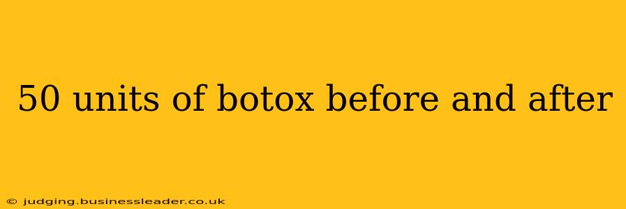 50 units of botox before and after