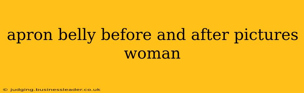 apron belly before and after pictures woman