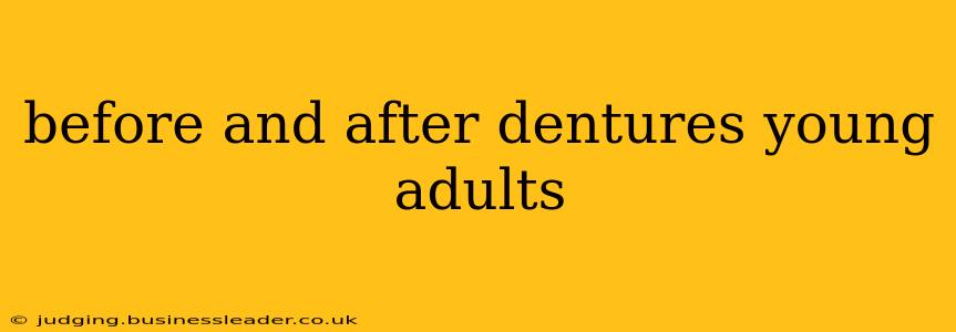 before and after dentures young adults
