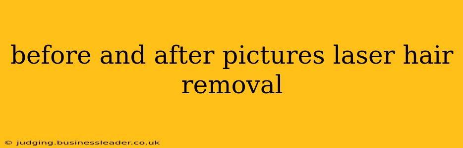 before and after pictures laser hair removal