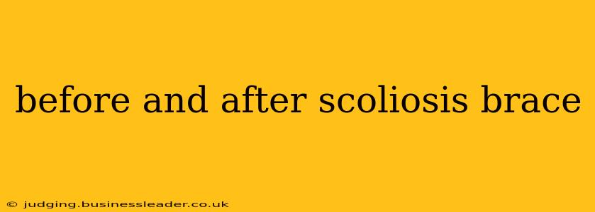 before and after scoliosis brace
