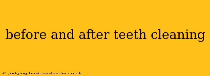 before and after teeth cleaning