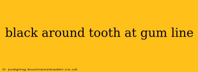 black around tooth at gum line