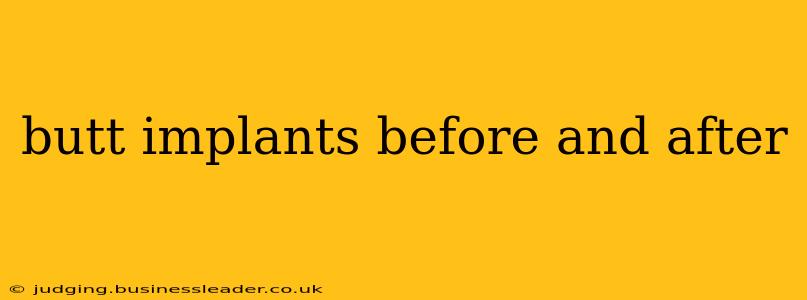 butt implants before and after