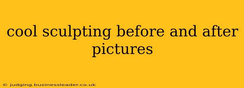 cool sculpting before and after pictures