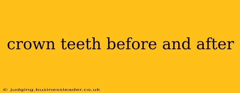 crown teeth before and after