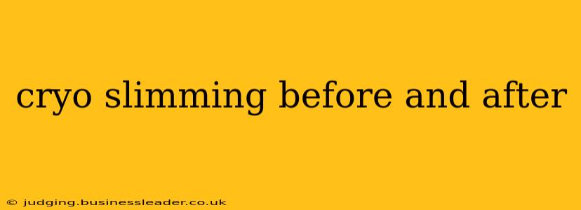 cryo slimming before and after