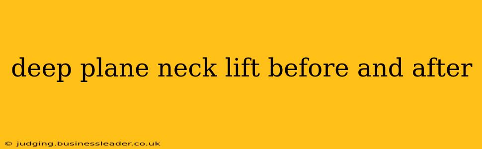 deep plane neck lift before and after