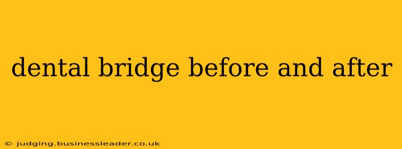 dental bridge before and after