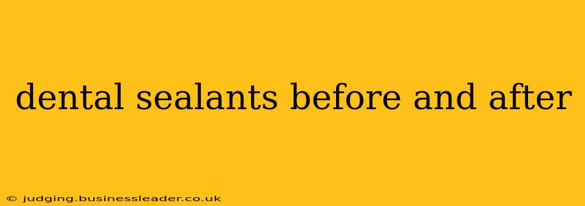 dental sealants before and after