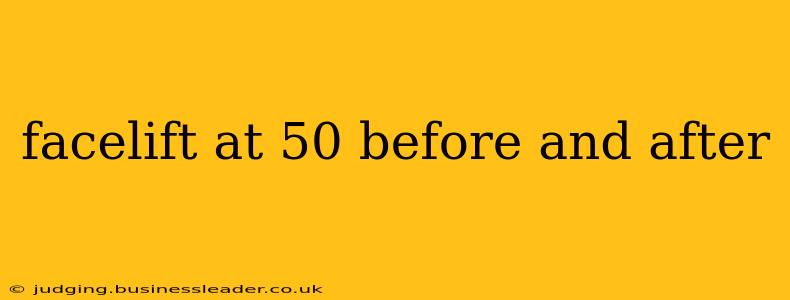 facelift at 50 before and after
