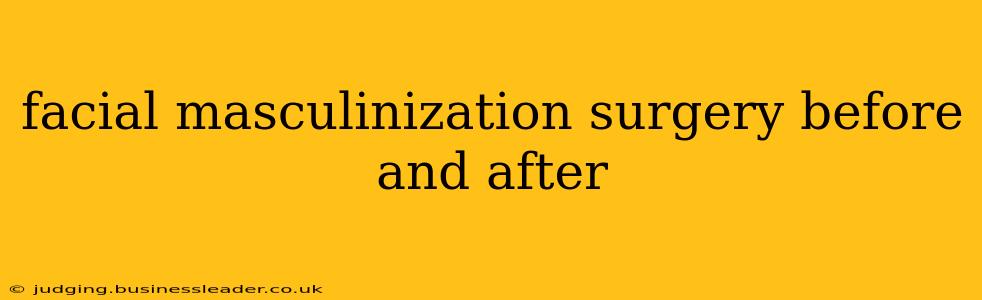 facial masculinization surgery before and after