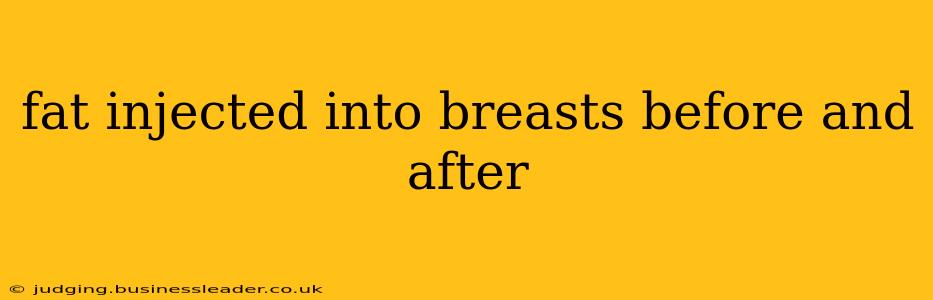 fat injected into breasts before and after