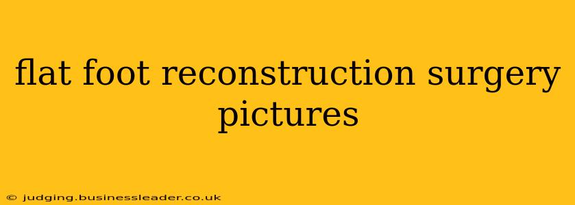 flat foot reconstruction surgery pictures