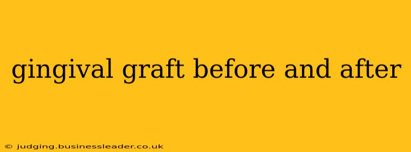 gingival graft before and after