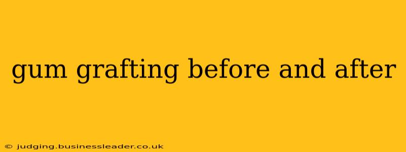 gum grafting before and after