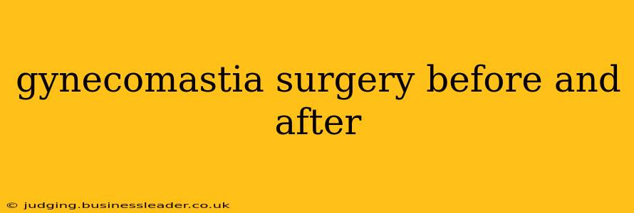 gynecomastia surgery before and after