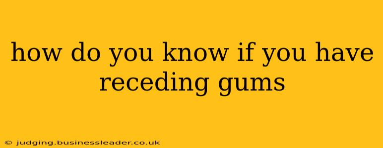 how do you know if you have receding gums