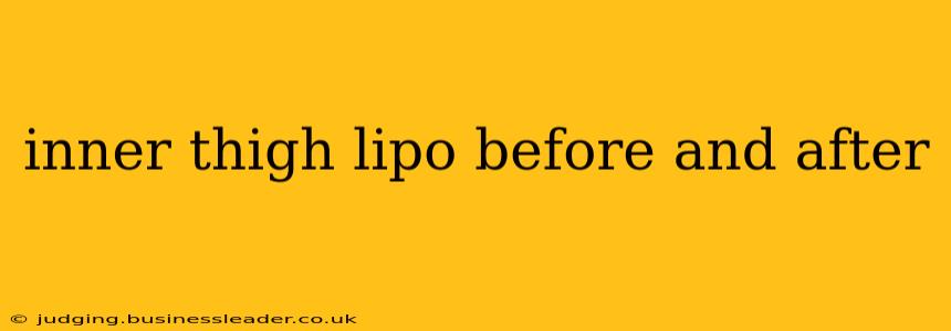 inner thigh lipo before and after