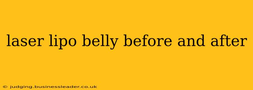 laser lipo belly before and after