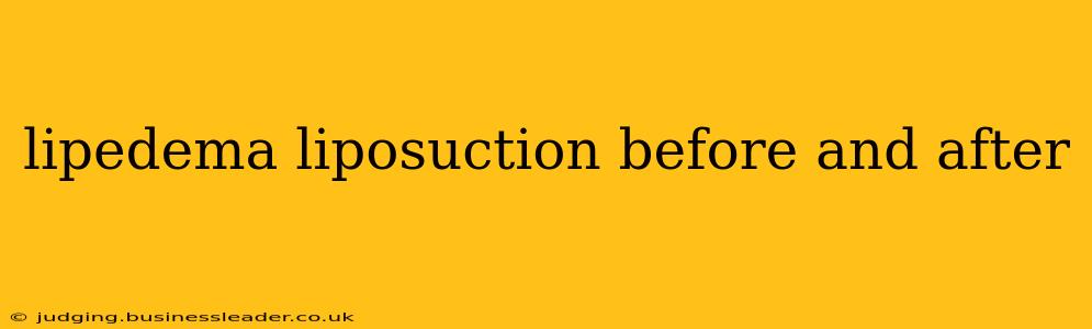 lipedema liposuction before and after