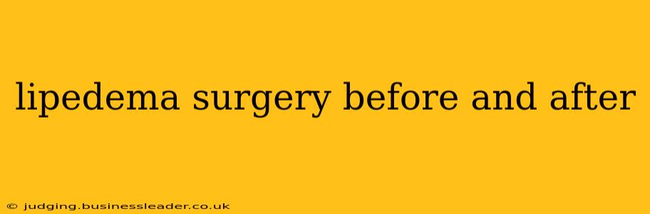 lipedema surgery before and after