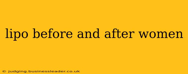 lipo before and after women