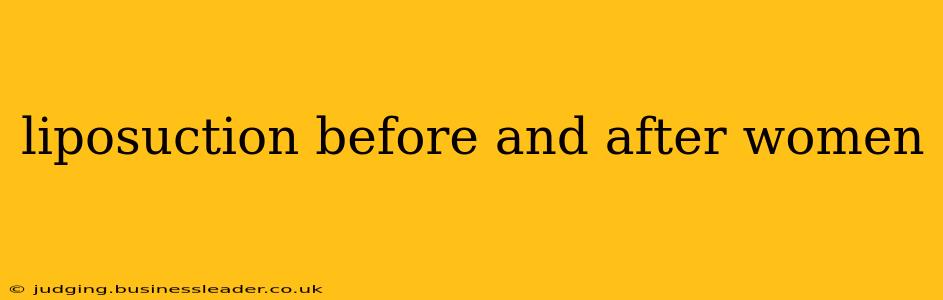liposuction before and after women