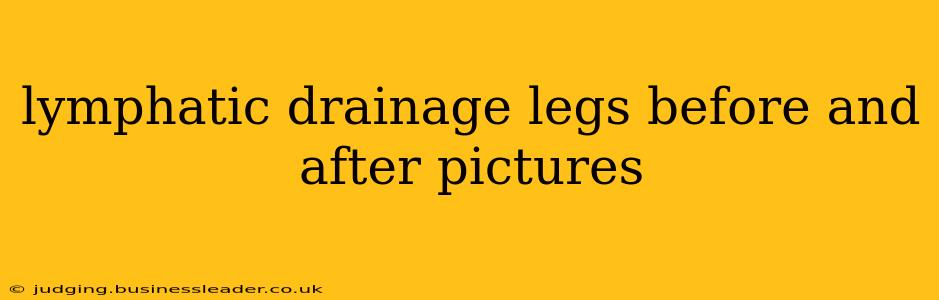 lymphatic drainage legs before and after pictures