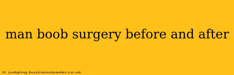 man boob surgery before and after