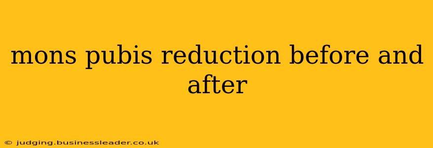 mons pubis reduction before and after
