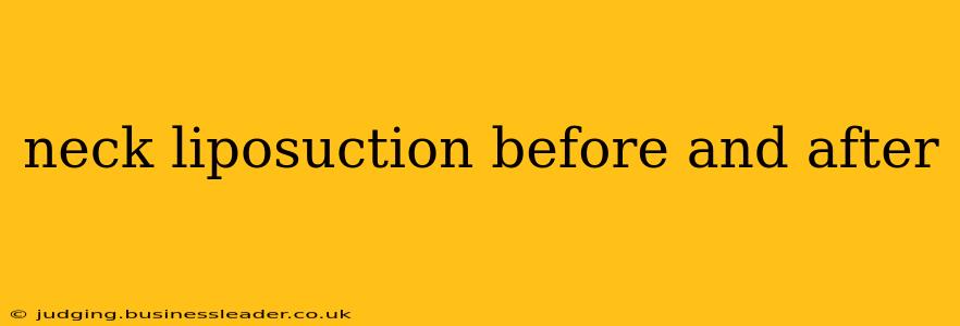 neck liposuction before and after