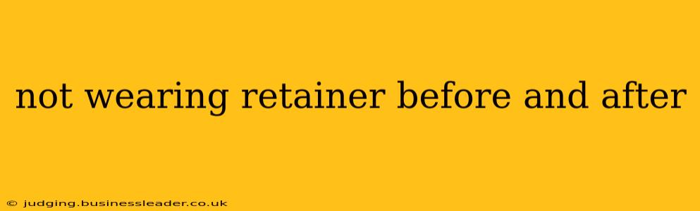 not wearing retainer before and after