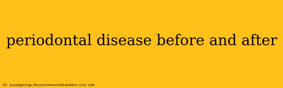 periodontal disease before and after
