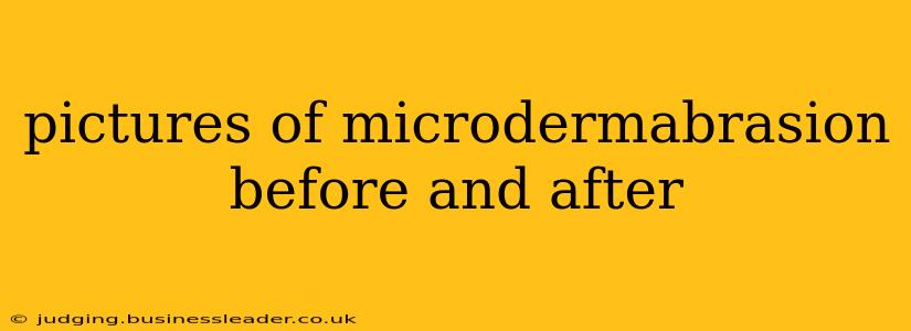 pictures of microdermabrasion before and after