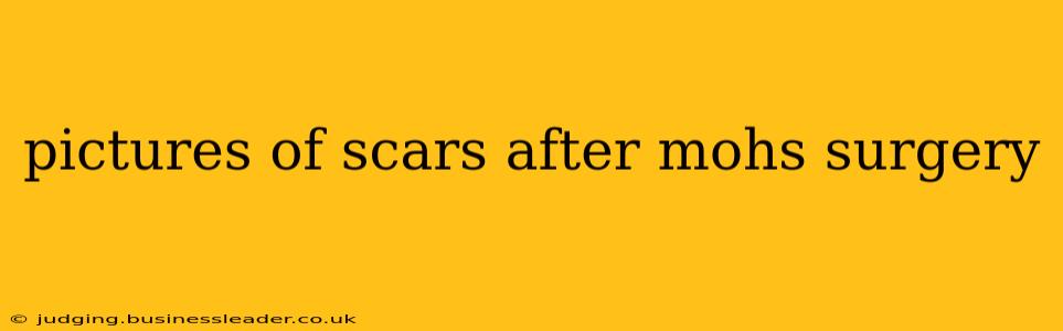 pictures of scars after mohs surgery