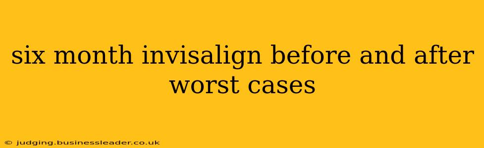 six month invisalign before and after worst cases