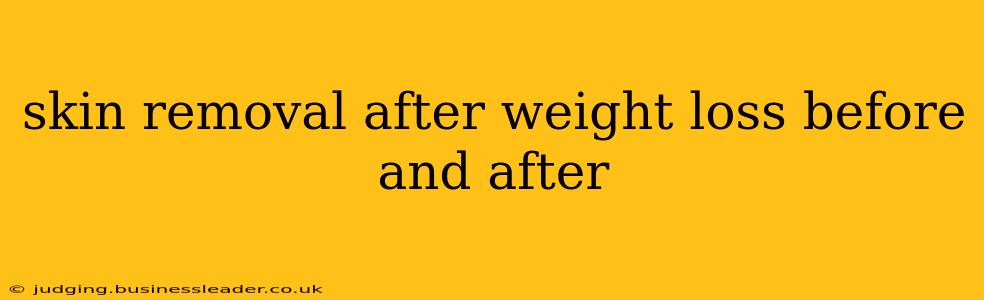 skin removal after weight loss before and after