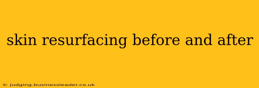 skin resurfacing before and after