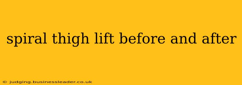spiral thigh lift before and after