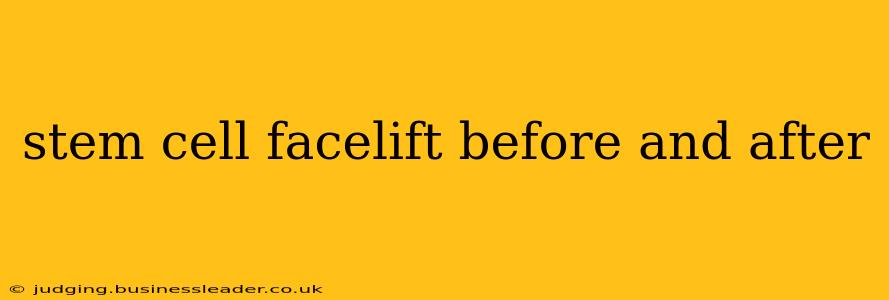 stem cell facelift before and after