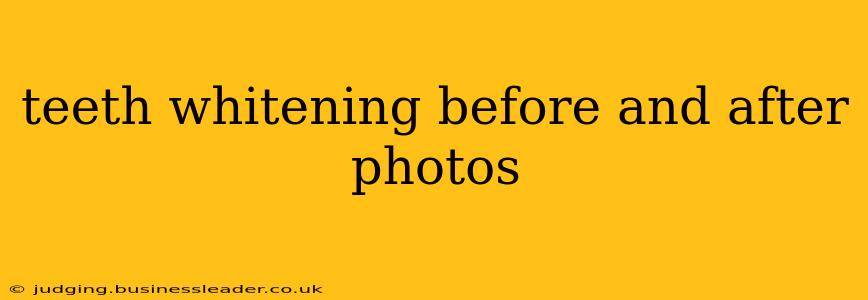 teeth whitening before and after photos