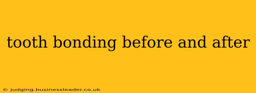 tooth bonding before and after
