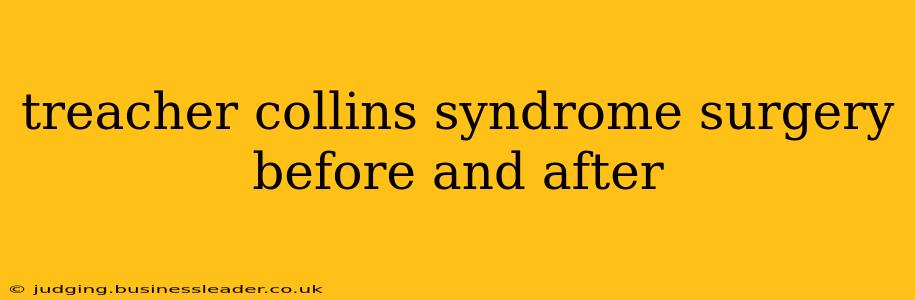 treacher collins syndrome surgery before and after
