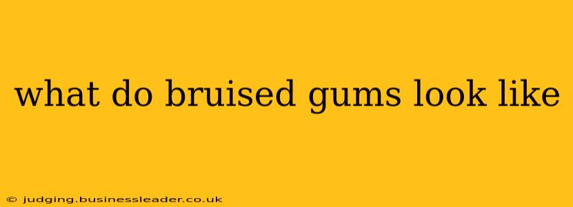 what do bruised gums look like