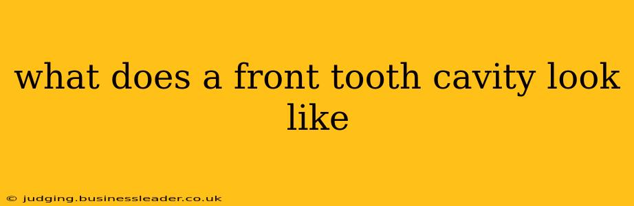 what does a front tooth cavity look like