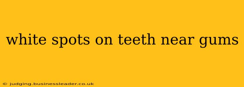 white spots on teeth near gums