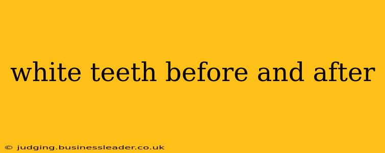 white teeth before and after