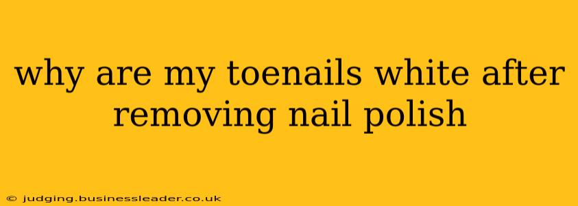why are my toenails white after removing nail polish