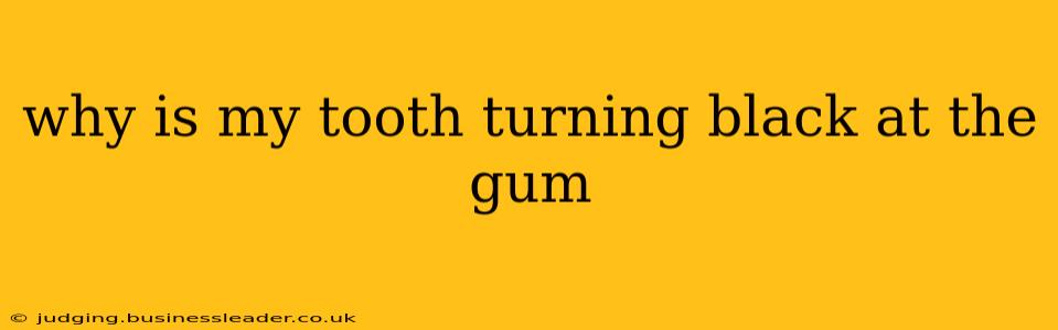 why is my tooth turning black at the gum